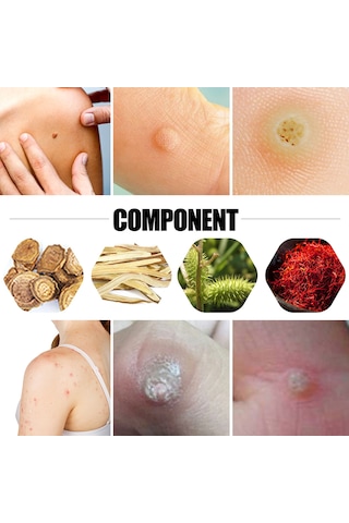 Moveevo Doğal İçerikli 12 Adet Nasır Ve Siğil Tedavi Bandı - Hızlı Çözüm