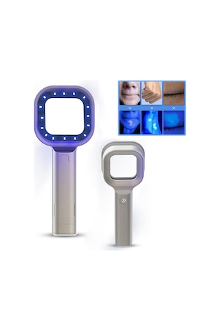 Wood Işığı Dermatolog Güzellik Merkezi Uv Cilt Analiz Cihazı