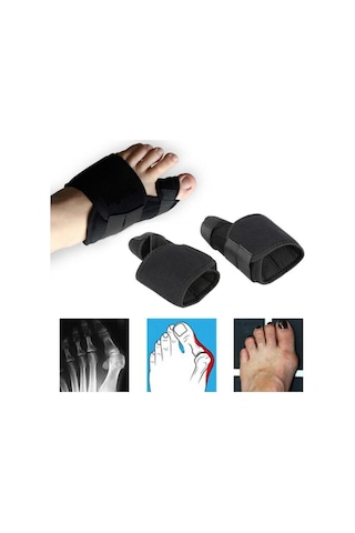 Medikal Halluks Valgus Gece Ateli Düzeltici Ayak Baş Parmak Kemiği Çıkıntısı Bunyon Kemik Koruyucu