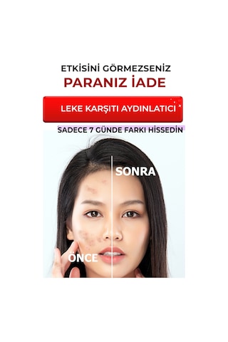 Siyah Nokta Karşıtı Ve Leke Karşıtı Yüz Bakım Serumu 2 Li Set