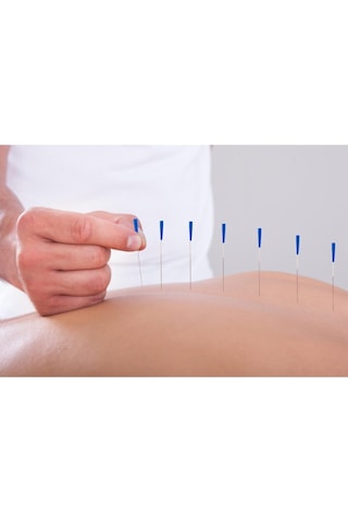 Maxi Akupunktur Iğnesi Kuru Iğne, Acupuncture Needle 0,30*40Mm Çok Renkli