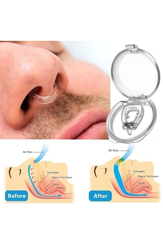 Mfa Taşınabilir Mini Manyetik Anti Horlama Burun Mandalı