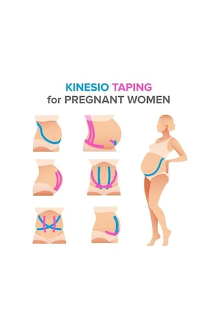 Medwelt Renkli Bantları Kinezyo Bandı 5cmx5m