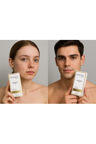 Sanjana Beauty Acne Serum 10 ML