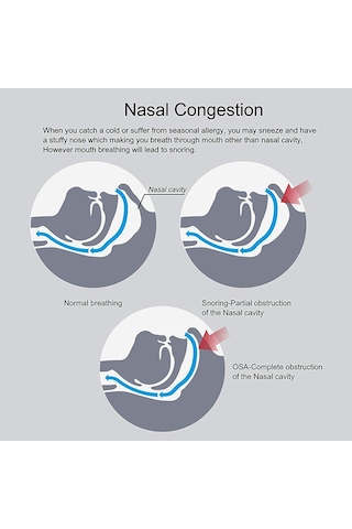 Lemestar Nefes Akışını Artıran Gece Uyku Konforu Burun Açıcı, Dört Farklı Boy S+m+l+xl Medikal Malzeme Reusable Snore Reducer