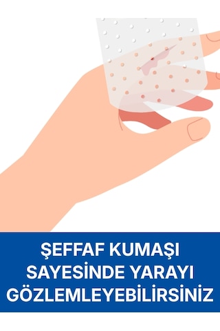 Pe 1,25cm X 5m Şeffaf Perforeli Flaster. Hipoalerjenik, Nefes Alabilen, Cilde Dost, Suya Dayanıklı