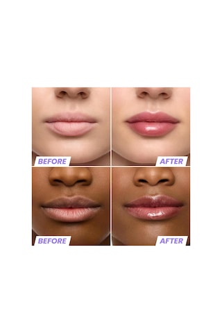 Wonderskin Lip Rehab Nemlendirici Ve Onarıcı Renkli Dudak Serumu Yağı Honey 3.57ml