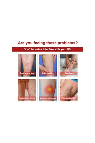 Vkemall Jaysuing Varis Rahatlatıcı Bant - Bacak Ağrısı Ve Şişlik İçin 12'li Paket