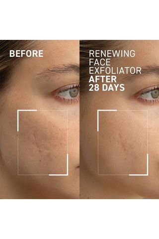 Dr.brandt Microdermabrasion Exfoliatıng Face Cream Cilt Bakım Kremi 60 Ml