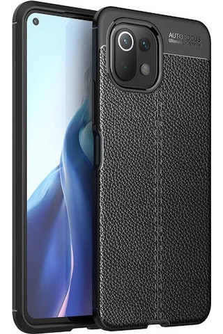 Xiaomi Mi 11 Lite Kılıf Zore Niss Deri Desenli Silikon Kılıf