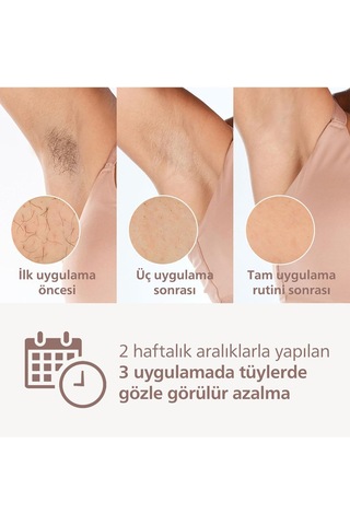Lumea Ipl 8000 Serisi Brı945/00, Evde Lazer Epilasyon, Vücut Ve Yüz İçin 2 Başlık, Çanta