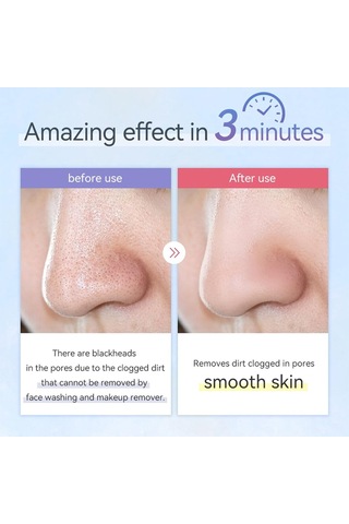 Anlan Ultrasonik Peeling Cilt Temizleyici Beyaz