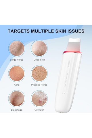 Anlan 6 Sı 1 Arada Ultrasonik Cilt Peeling Cihazı, Su Geçirmez, Ems, Led Işık Terapili Gözenek Temizleyici Masaj Aletleri