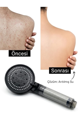 5 Fonksiyonlu Filtreli Duş Başlığı 2 Yedek Filtre Su Arıtmalı, Klor Ve Kireç Önleyici, Yüksek Basınçlı siyah