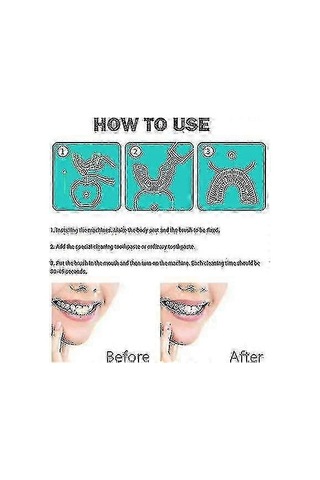 Elektrikli Diş Fırçası Yetişkinler - Ultrasonik U-şekilli Diş Fırçaları - 360 Ağız Temizleme - Kablosuz Şarj Ve Led Işık - Siyah Sertifikalı Whit Walkbee