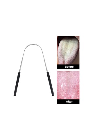 Dolıty Diller Kazıyıcı Taze Nefes Için Temizleyici Siyah