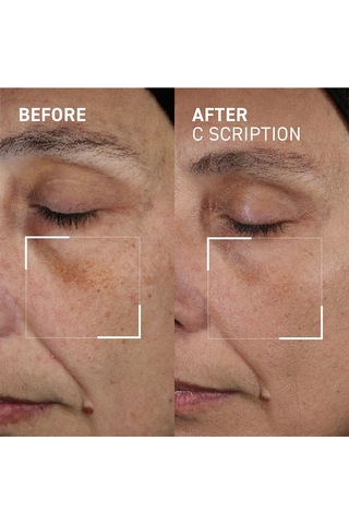 Dr. Brandt Bright This Way C Scrıptıon Serum 30 Ml