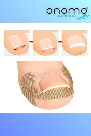 Batık Tırnak Düzeltme Bandı 20 Adet