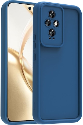Zore Honor 200 Kılıf Kamera Korumalı Msra Ananas Kapak - Siyah Siyah