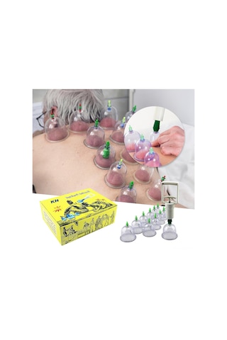 Samdoo 12 Bardaklı Profesyonel Vakum Şişe Seti - Kas Gevşetici, Kan Akışını Artırıcı Akupresür Masaj Aleti Çok Renkli