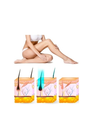 Yui Iplv15 Pro Vücut -yüz- Bikini Başlıklı Ağrısız Otomatik Ve Manuel Atım Buz Lazer Epilasyon