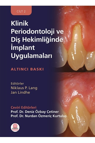 Klinik Periodontoloji Ve Diş Hekimliğinde İmplant Uygulamaları