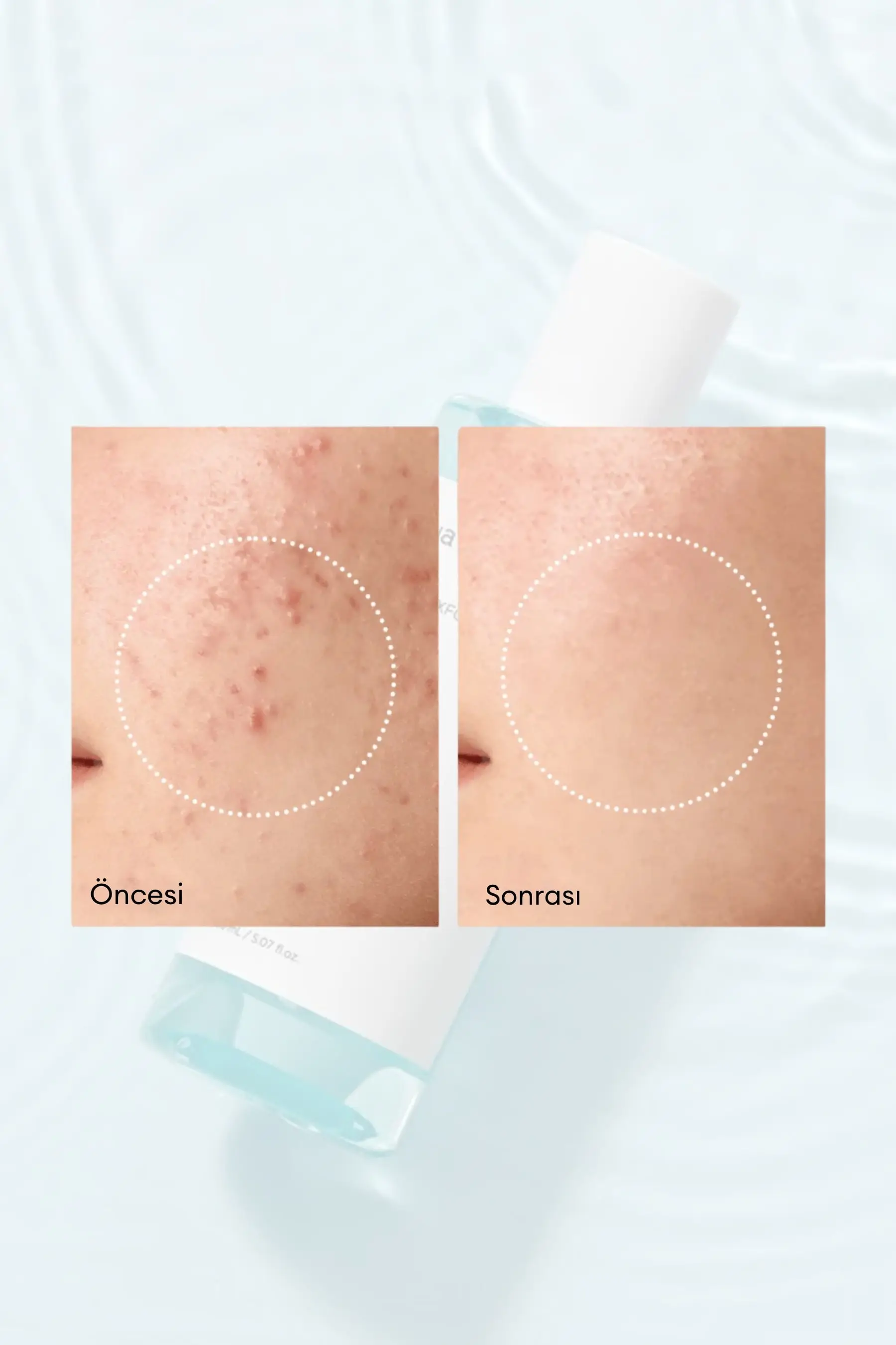 Anua Bha 2 Gentle Exfoliating Toner