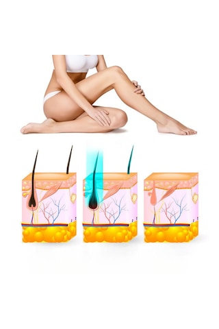 Yui Iplv15 Pro 3 Başlıklı Buz Lazer Epilasyon Cihazı