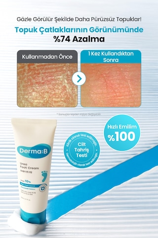 Kuru Ve Çatlamış Topuklar İçin, Peeling Etkili Nemlendirici Ayak Kremi Derma:b Urea Foot Cream