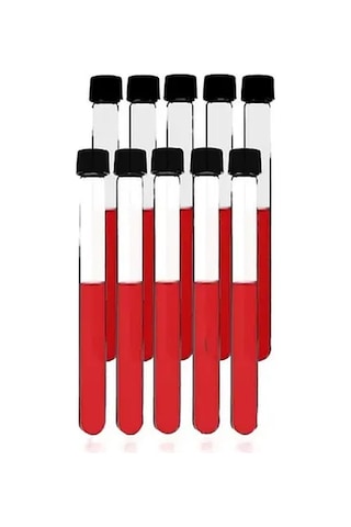 Deney Tüpü Cam Vida Kapaklı Dibi Yuvarlak 10 Adet Boy 160 Mm