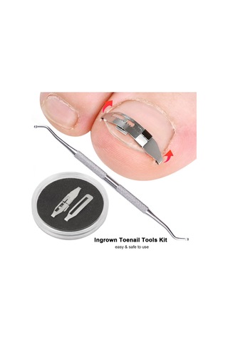 Qingmipy Tırnak Batması Düzeltici Seti - 2 Adet Takılabilir Aparat + Medikal Bant + Tırnak Kaldırıcı