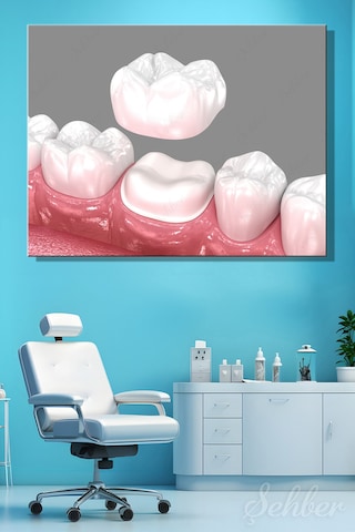 Diş Tacı Yerleşimi Diş Kronunu 3d Tıbbi İllüstrasyon Tekli Kanvas Tablo Yatay 3588