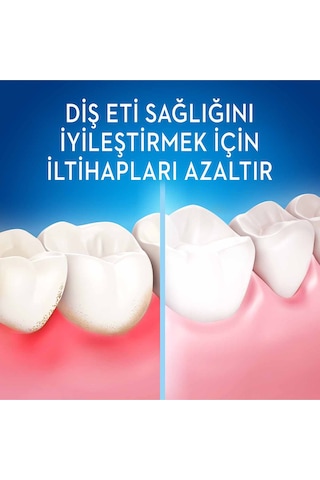 Oral-B Allrounder Black Manuel Diş Fırçası 1