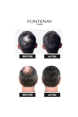 Saç Dolgunlaştırıcı Keratin Fibers Açık Kahve Topik Saç Tozu 50gr + Saç Spreyi 400ml 2'li S Renkli