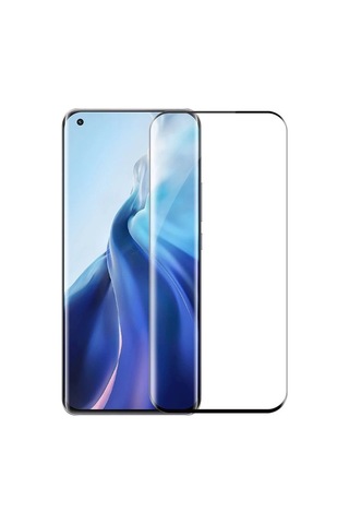 Smcase Xiaomi Mi 11 Ultra Kılıf Lüks Kamera Korumalı Karbon Silikon Tam Kapatan Ekran Koruyucu