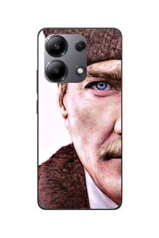 Xiaomi Redmi Note 13 Pro 4g Kamera Korumalı Baskılı Desenli Özel Seri Kılıf Kapak Renk2 Renk2