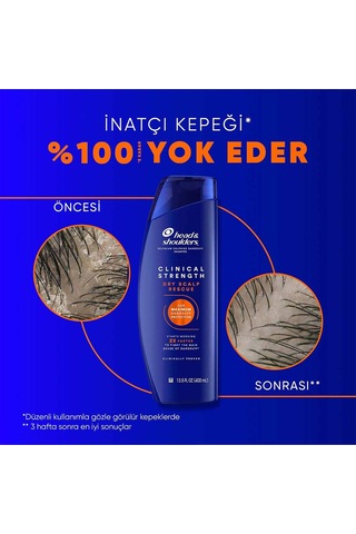 Clinical Strength Dry Scalp Rescue Kuru Saç Derisine Özel Şampuan 400 Ml X2 Adet