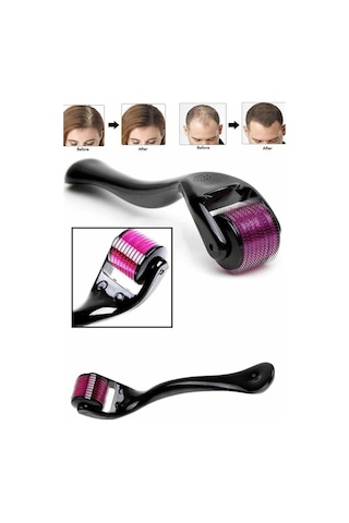 Derma Roller Titanyum Uçlu 540 İğneli 1 Mm Saç Sakal Çıkarma Ve Cilt Bakım Masaj Aleti Uuczdermaroller3
