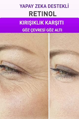 Retinol + Nemlendirici Serum 2 Li Set Alın Çizgisi Göz Çevresi