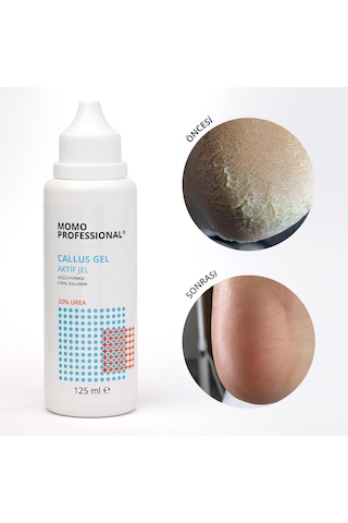 Callus Gel, Nasır Sökücü Keratolitik Pedikür Jel, 125 Ml