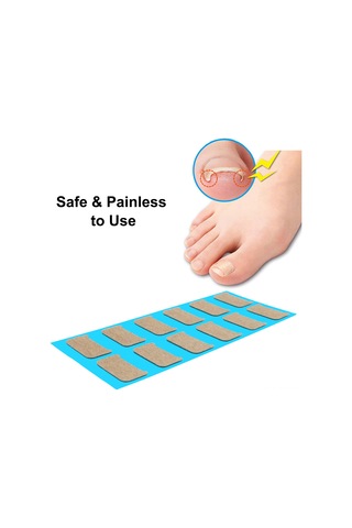 Qingmipy Oturmuş Tırnak Düzeltme İçin Tpu Zımba Jeli, Yapıştırıcı Gereksiz, 36 Adet Kare Şekilli Kırmızı Tırnak Sticker Seti