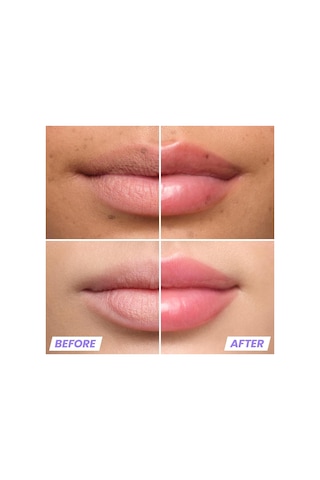 Wonderskin Lip Relapse Dolgunlaştırıcı Etki Şeffaf Dudak Parlatıcısı Clear 3.57ml Clear