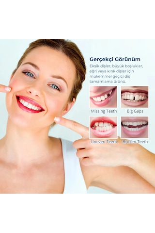 Soulbyee Geçici Diş Onarım Kiti 30 G
