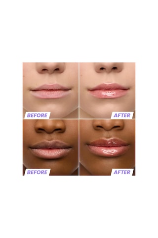 Wonderskin Lip Rehab Nemlendirici Ve Onarıcı Renkli Dudak Serumu Yağı Lover 3.57ml