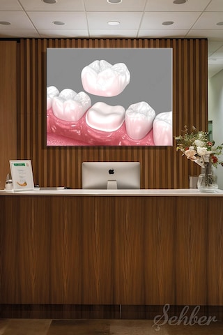 Diş Tacı Yerleşimi Diş Kronunu 3d Tıbbi İllüstrasyon Tekli Kanvas Tablo Yatay 3588
