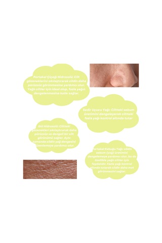 Skin Care Toner - Yağlı Ciltler İçin Cilt Bakım Suyu