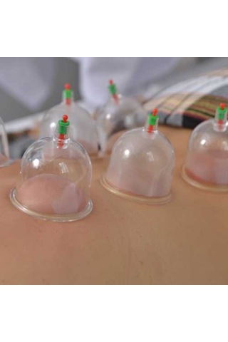 Premium Günlük Kullanım Kişisel Bakım Vücut Bakımı Kupa Çekme Hacamat Seti 6 Adet Çok Renkli