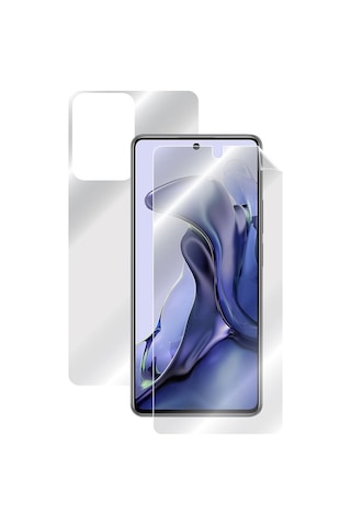 Ipg Xiaomi 11T - Mi 11T Tam Kaplama (Ekran Ve Arka Koruma)