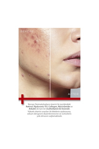 Todays Clinicals Retinol Shea Butter Onarıcı Nemlendirici Krem 100 ML