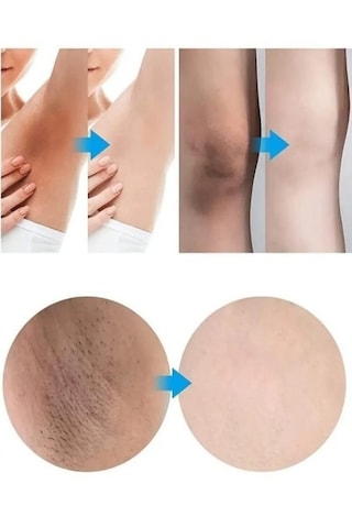 Kanza Beauty Cilt Beyazlatıcı Kem 30 G